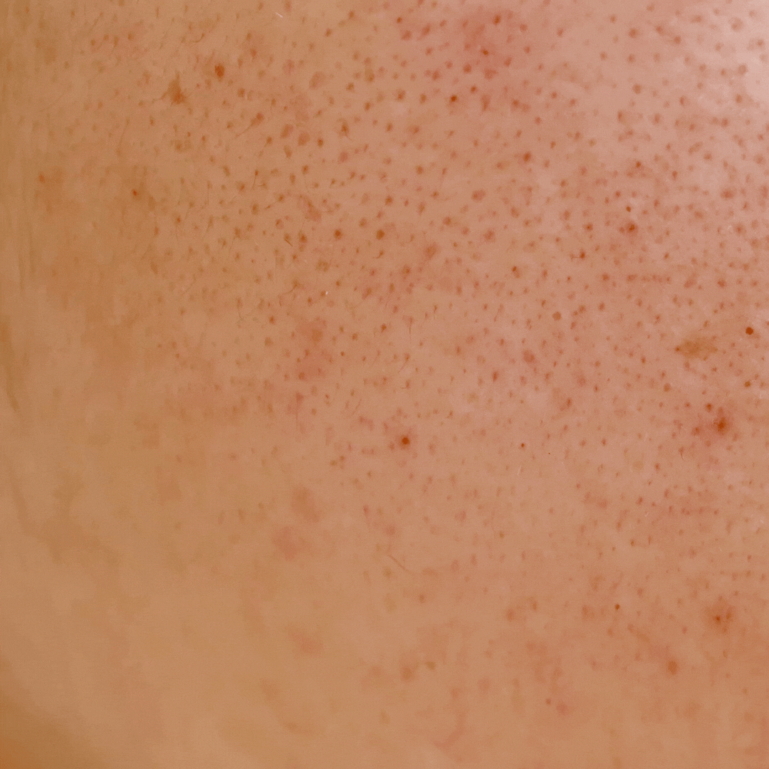 GlowGlide™ | Glycolic Acid Exfoliating Body Stick