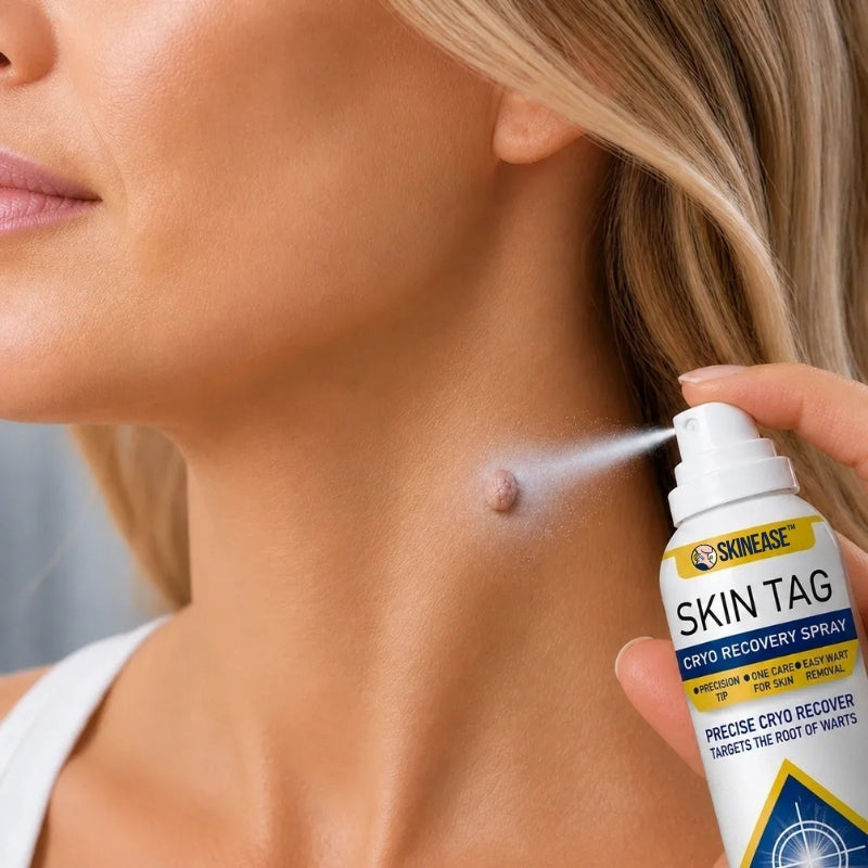 SkinEase™ | Cryotherapy Spray