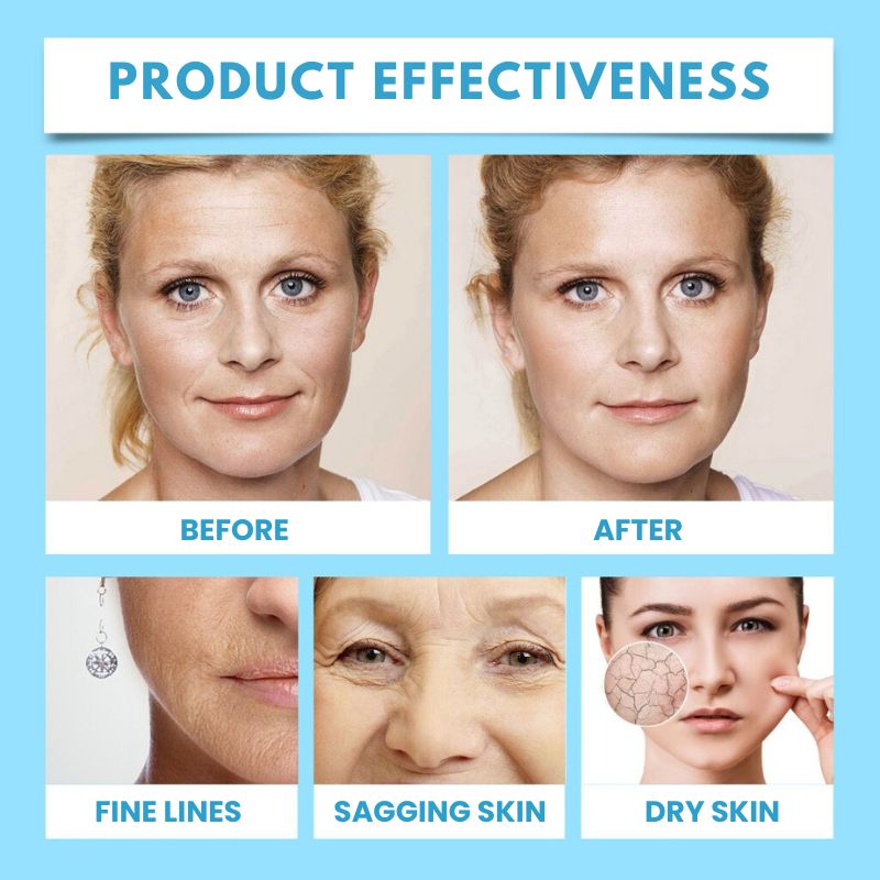 SmoothSkin™ | Rediscover Your Youthful Appearance in Just 5 Days!