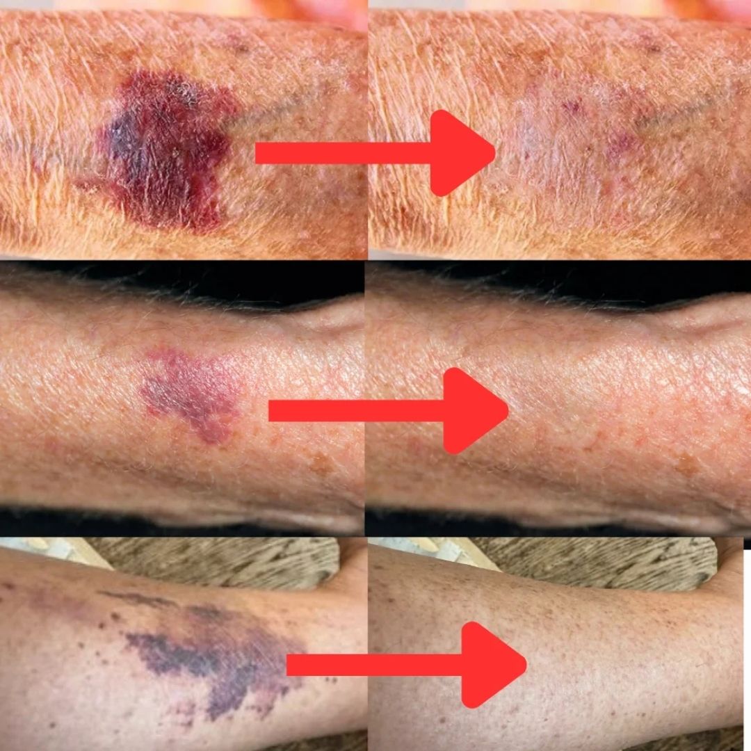 FortiSerum™ | Restore Confidence and Deep Hydration