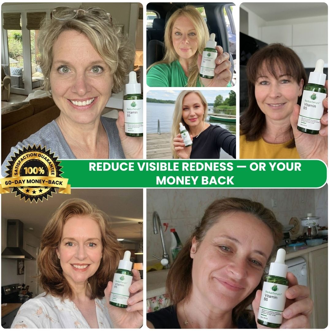 ReduxSerum™ | Anti-Redness-Serum