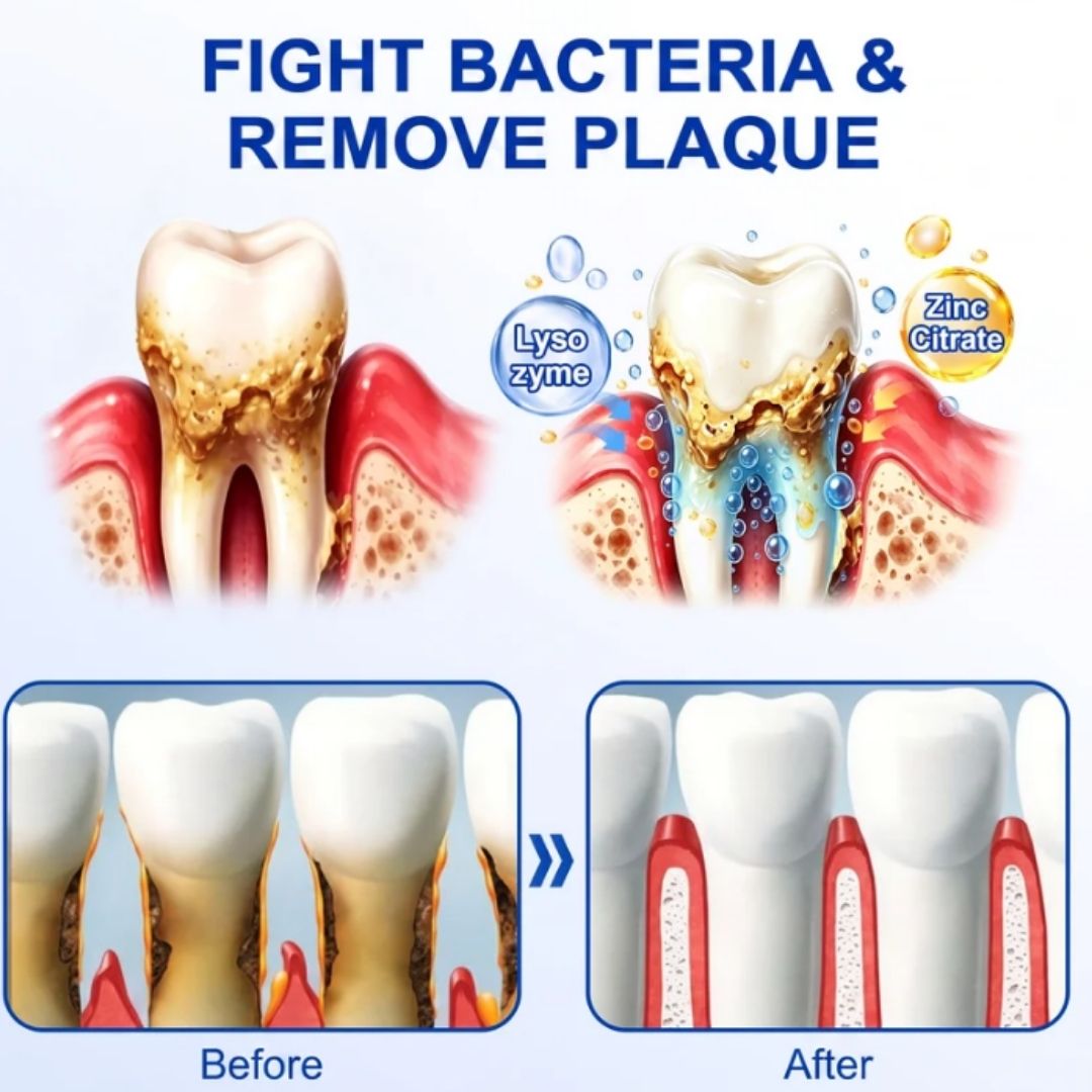 GumSeal™ | Periodontal Repair Gel