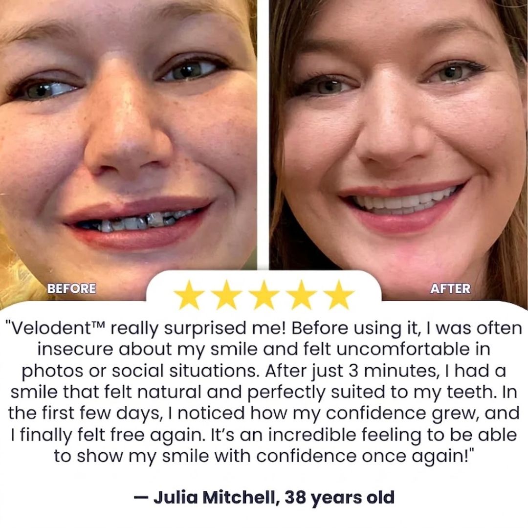 Velodent™ | Dentures Set