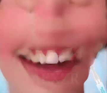 SmileGlow™ | שיניים לבנות וזוהרות תוך 3 שניות בלבד!