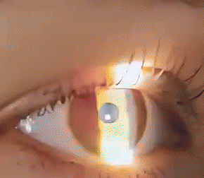 PureVision™ | Vision Enhancing Roller