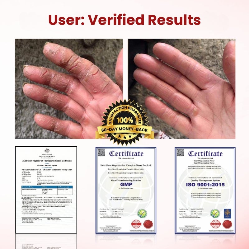VitaGluco™ | Diabetic Skin Repair Cream