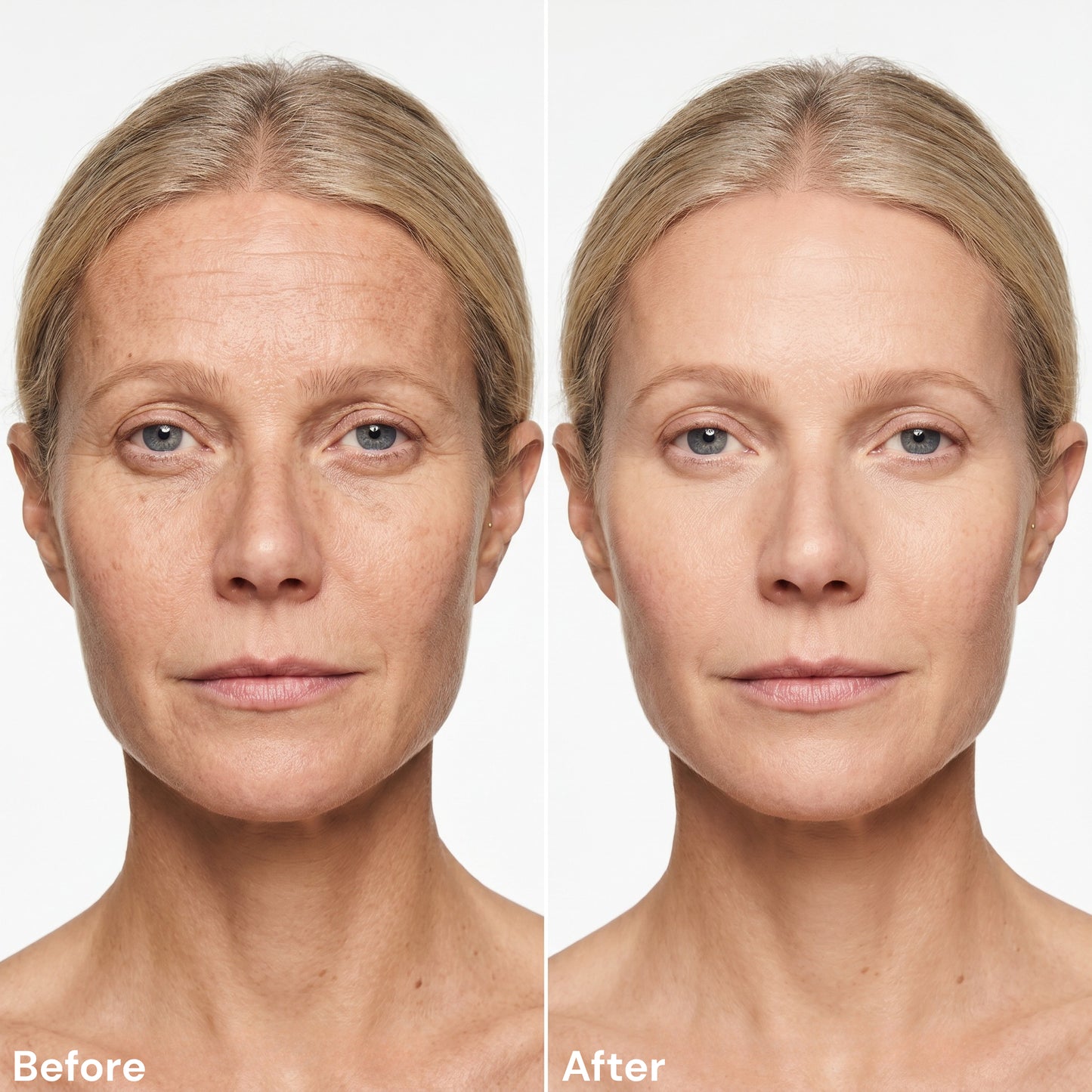 AgeLift™ | Skin Firming Cream