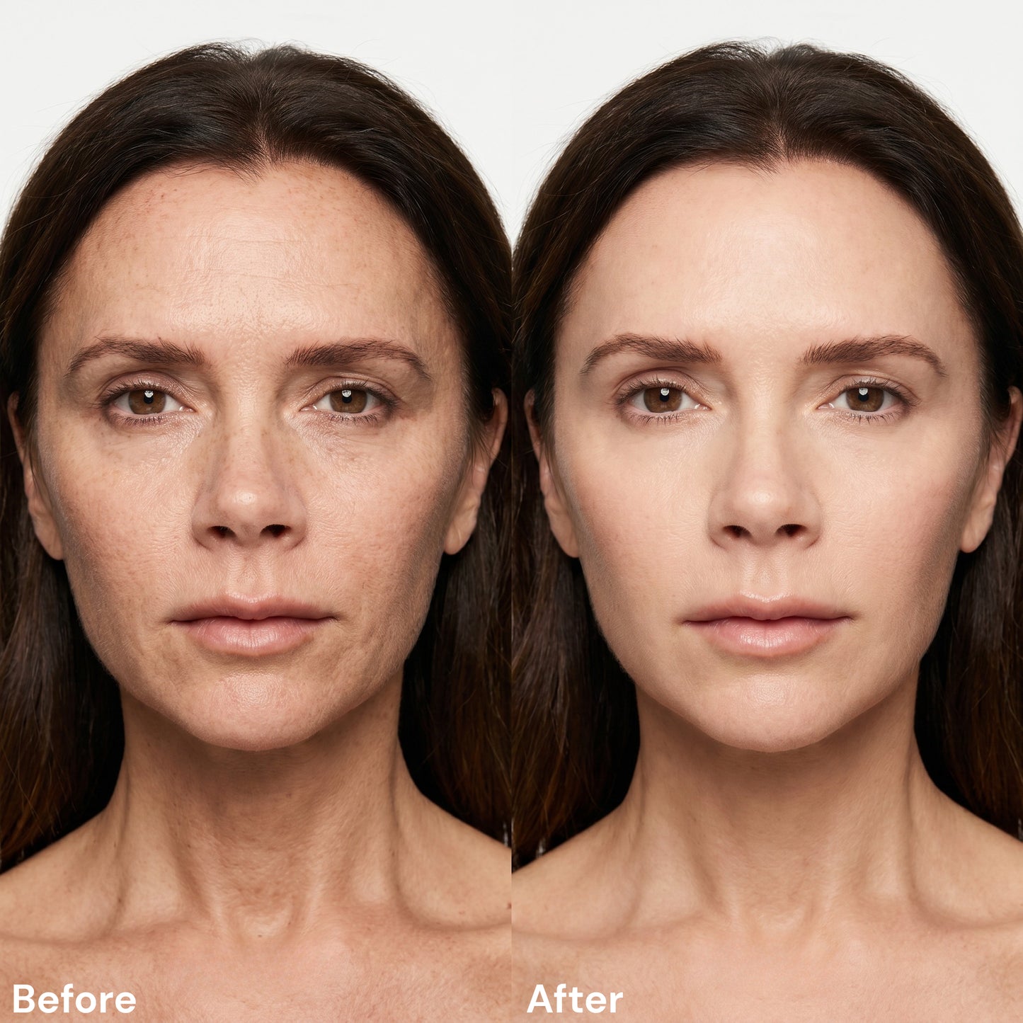AgeLift™ | Skin Firming Cream