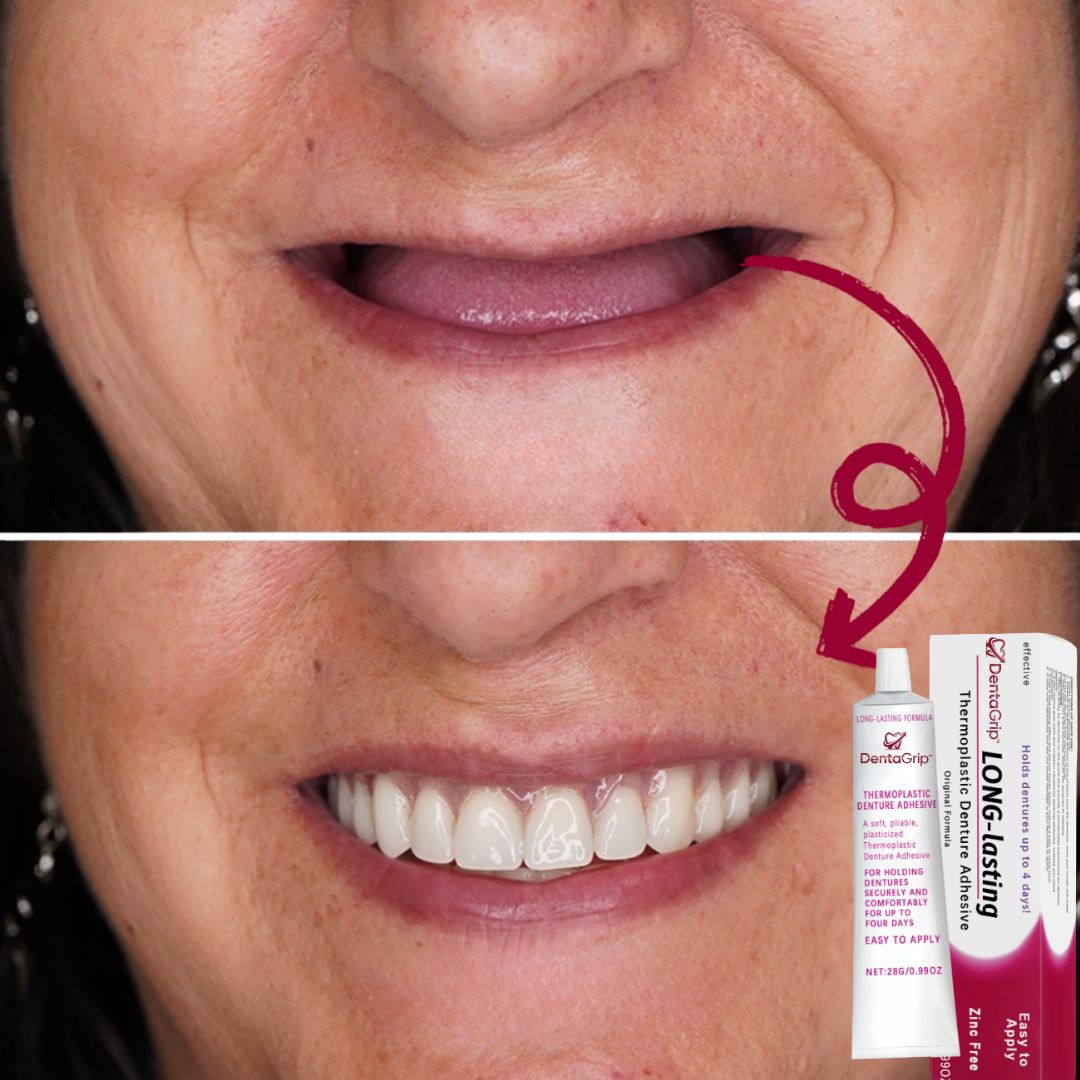 DentaGrip™ | Denture Adhesive