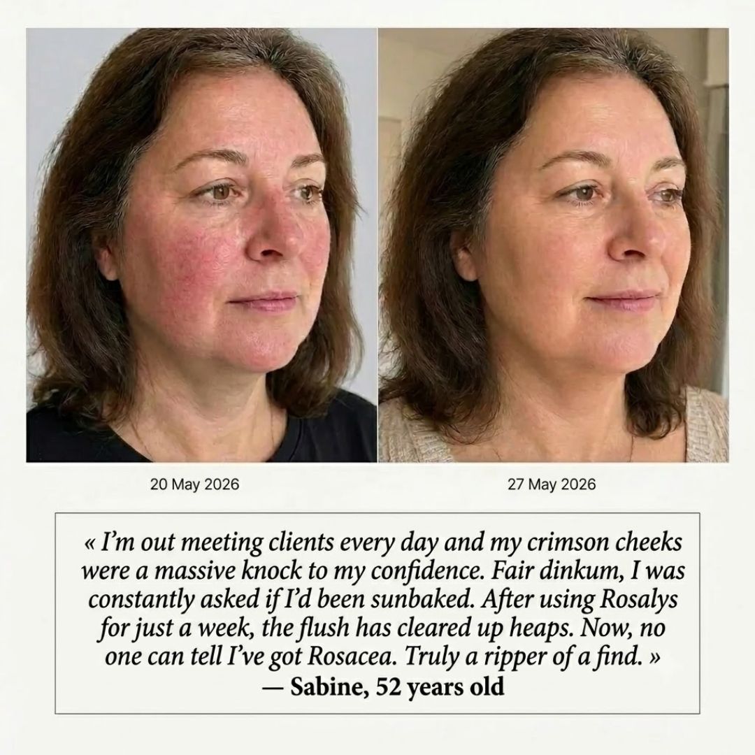 ReduxSerum™ | Anti-Redness-Serum