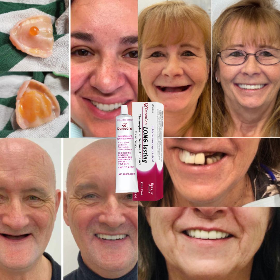 DentaGrip™ | Denture Adhesive