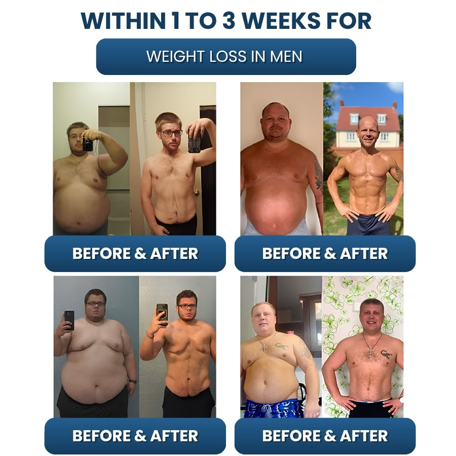 SlimFit™ | Slimming Bracelet