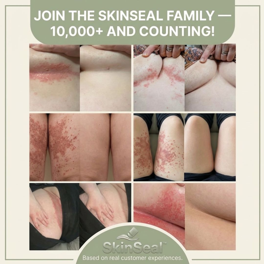 SkinSeal™ | Anti-Friction Stick