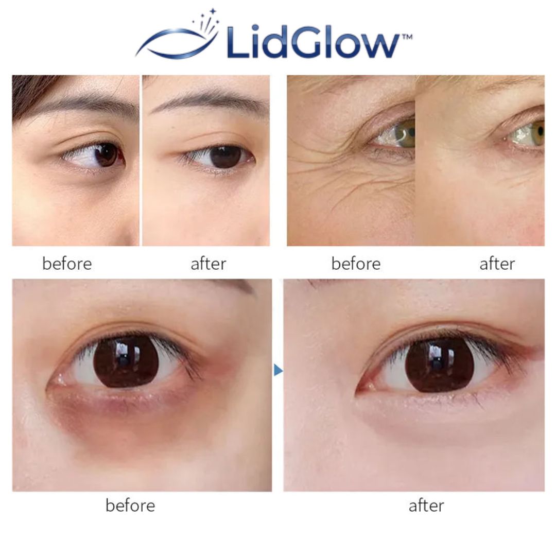 LidGlow™ | Lifting Eye Cream