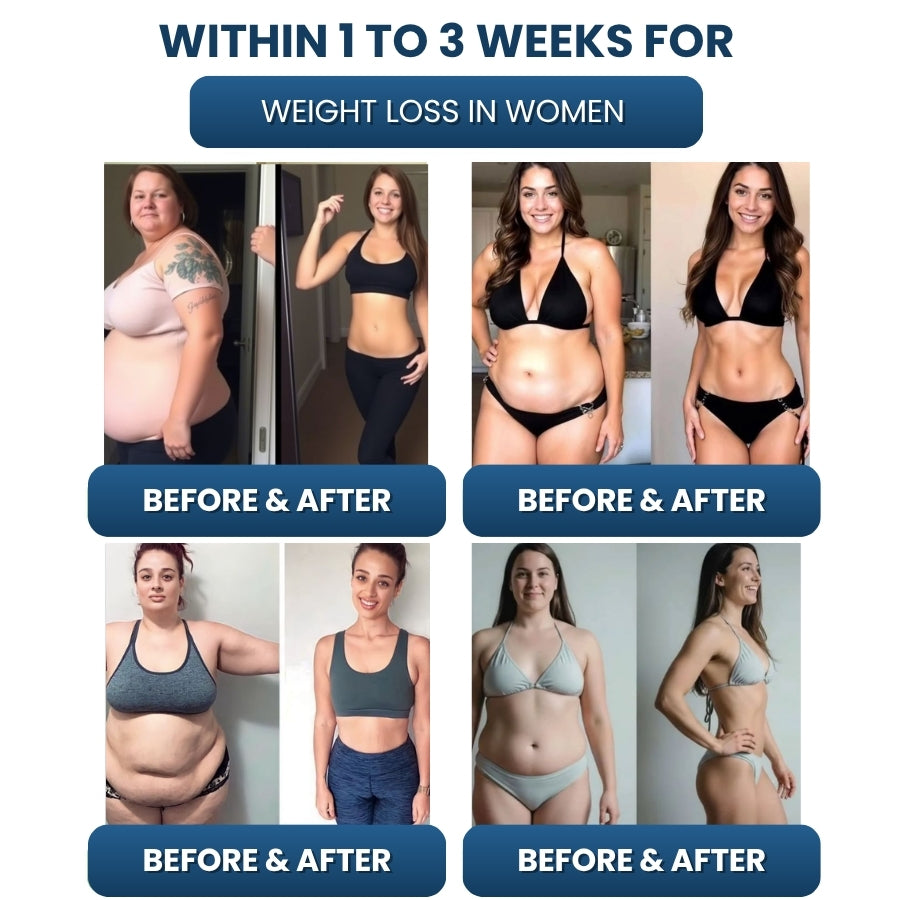SlimFit™ | Slimming Bracelet