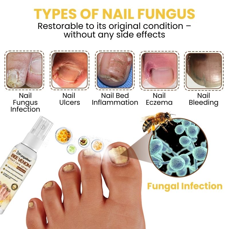 FungaBee® | Nail Care Spray with Bee Venom