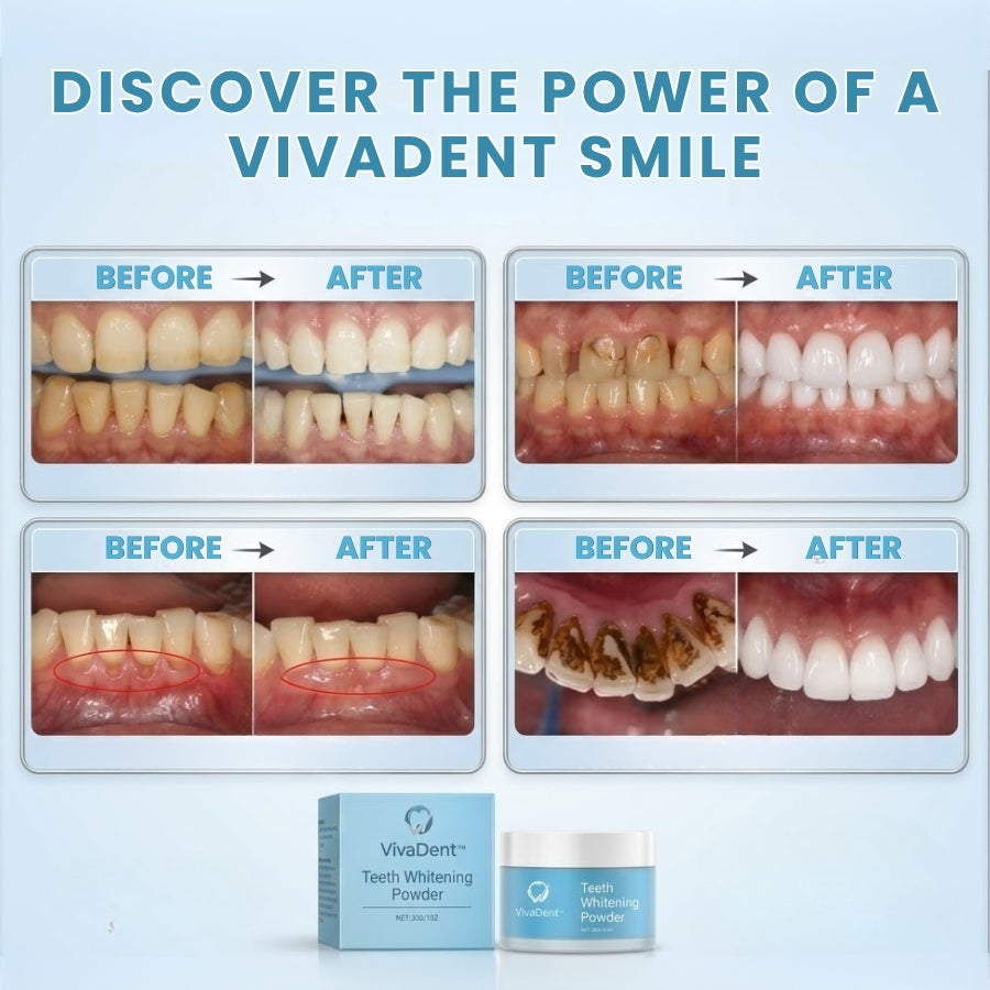 VivaDent™ | Tooth Repair Powder
