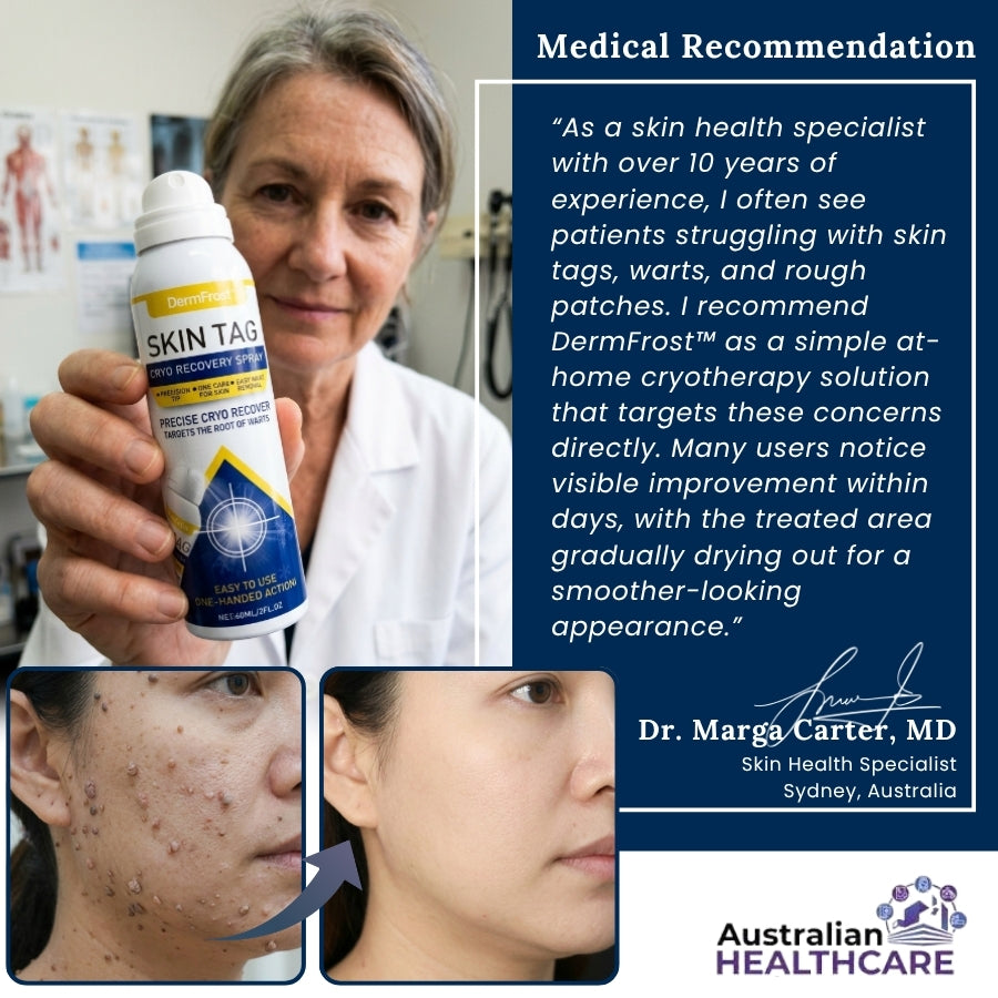 DermFrost™ |  Skin Tag Cryo Recovery Spray