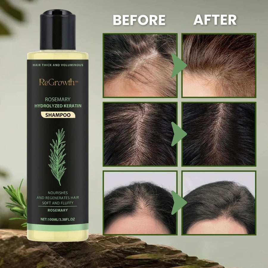ReGrowth™ | Organic Rosemary Hair Growth Shampoo