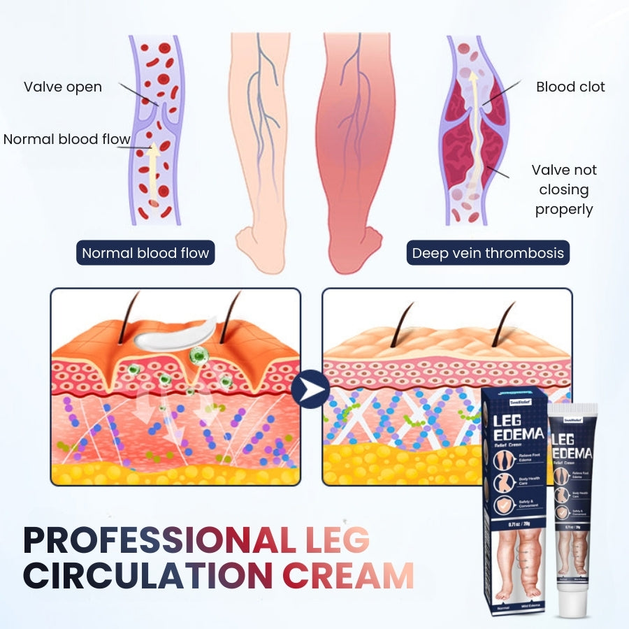 SwelRelief™ | Cream for Relief of Leg Swelling