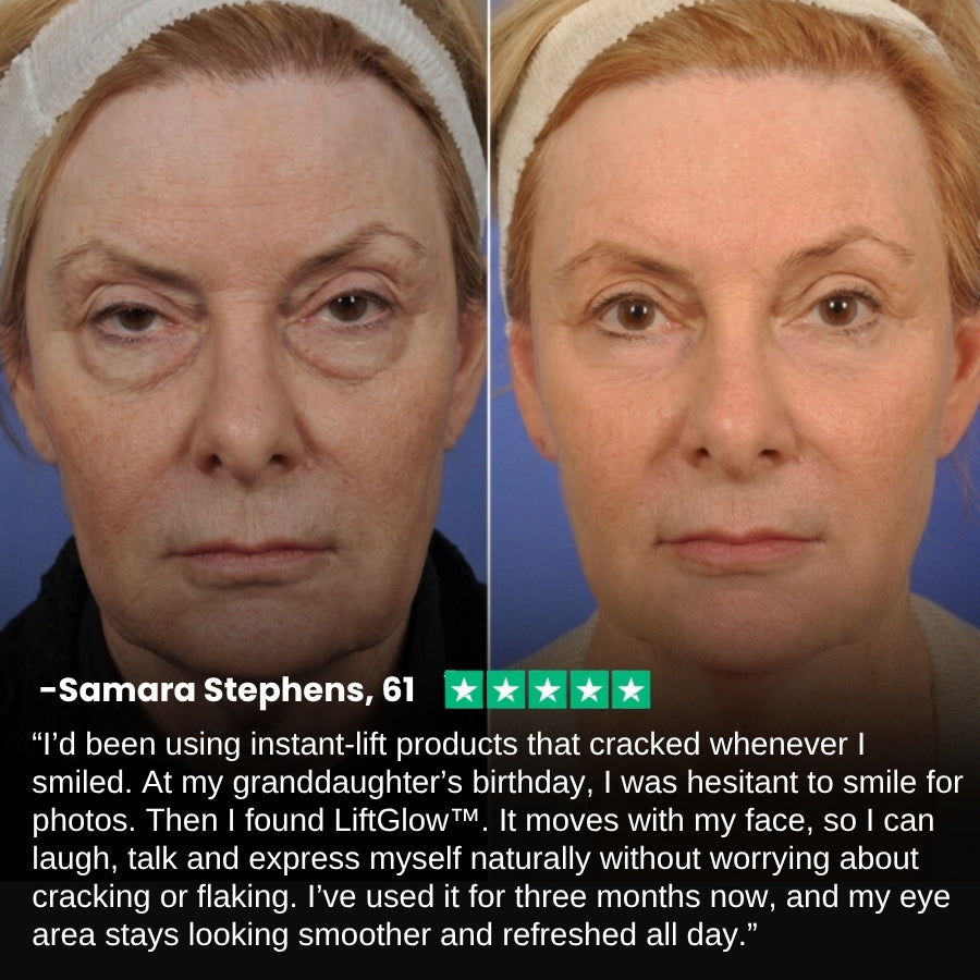 LiftGlow™ | Eye Anti-Wrinkle Roll-On