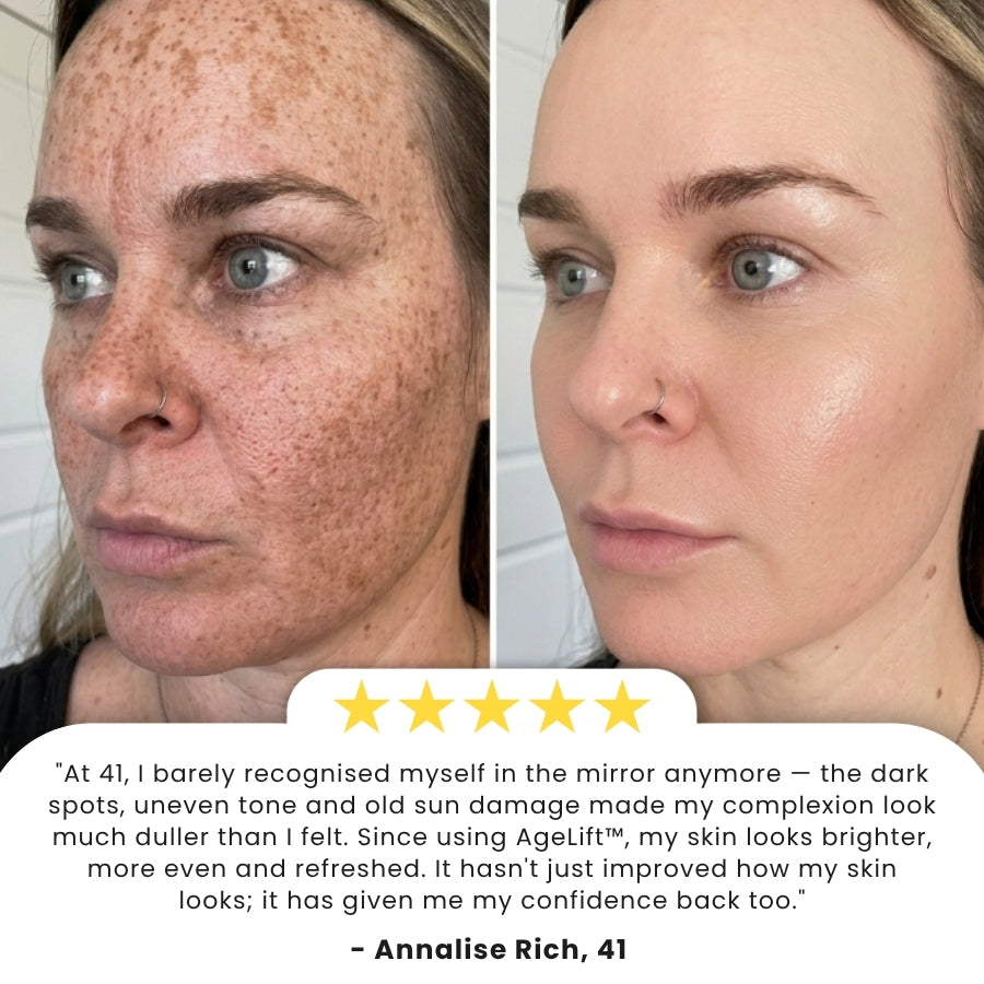 AgeLift™ | Skin Firming Cream