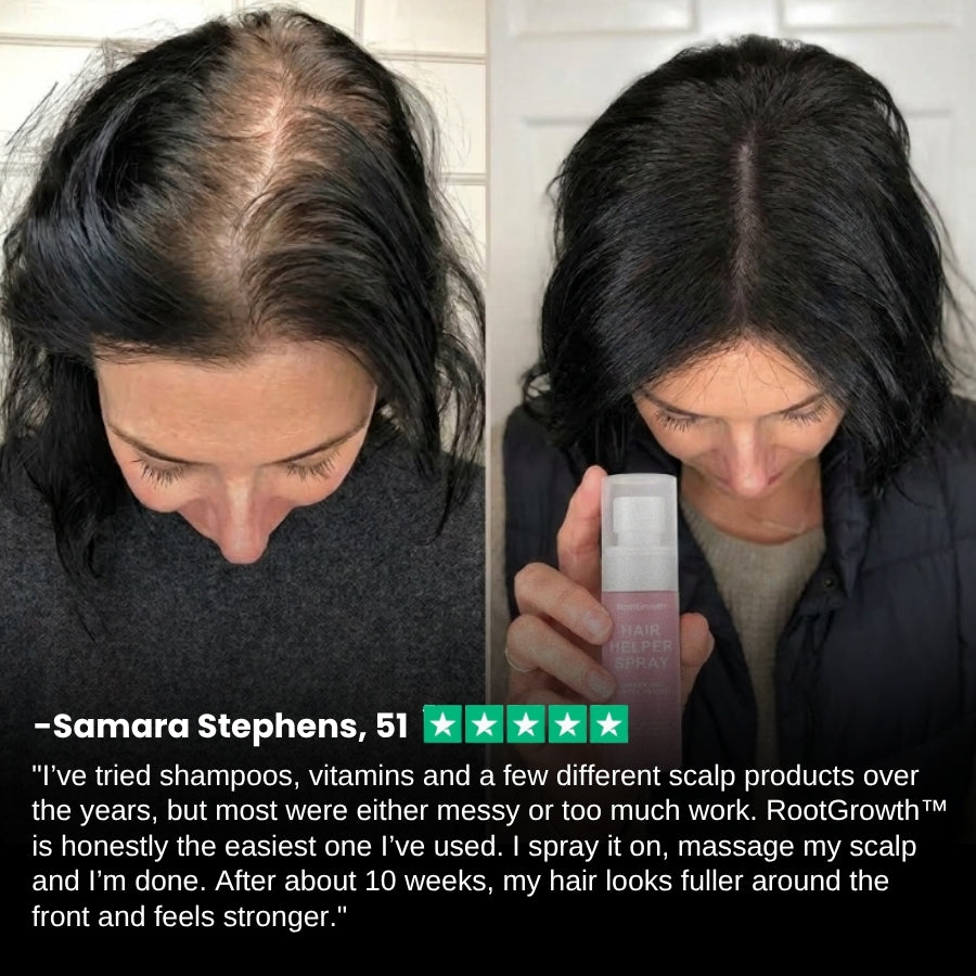 RootGrowth™ | Hair Helper Spray