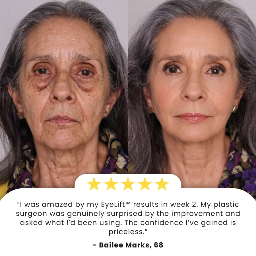 EyeLift™ | Instant Lift & Brighten Eye Cream