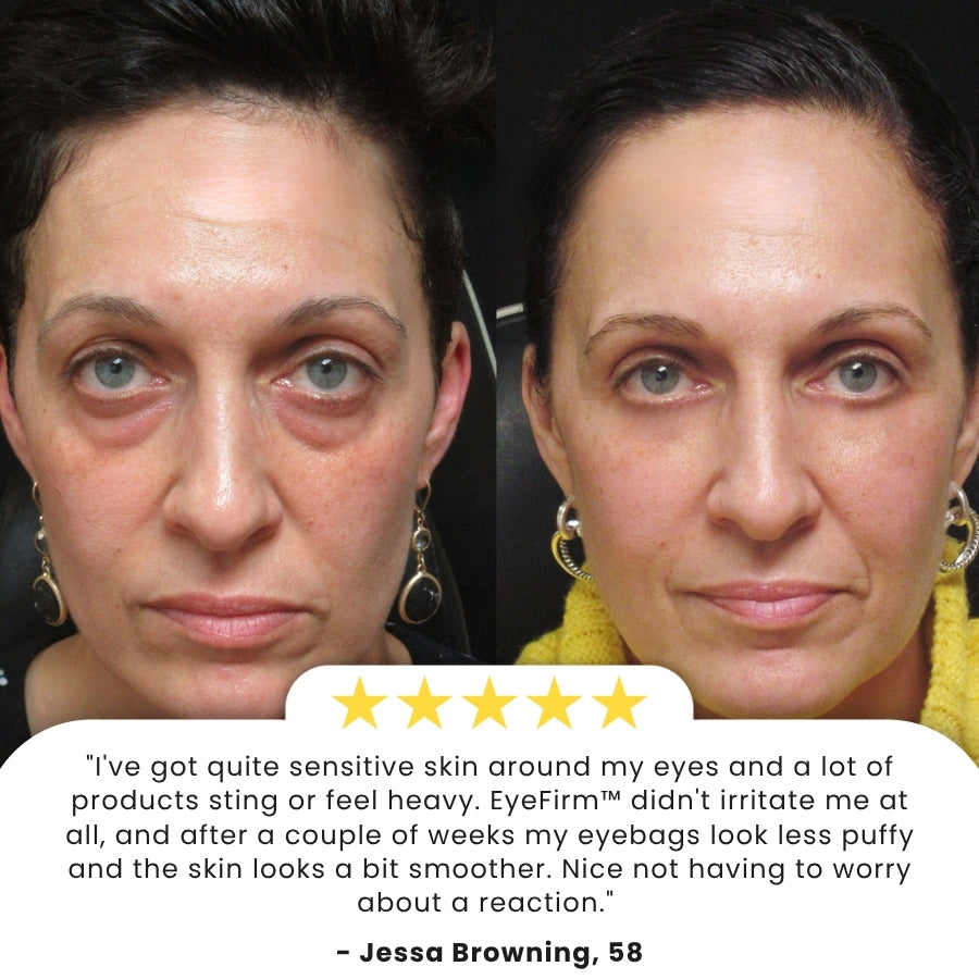 EyeFirm™ | Firming Retinol Eye Stick