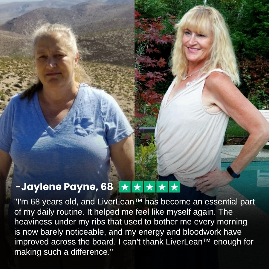 LiverLean™ | Liver Support & Metabolic Balance Formula