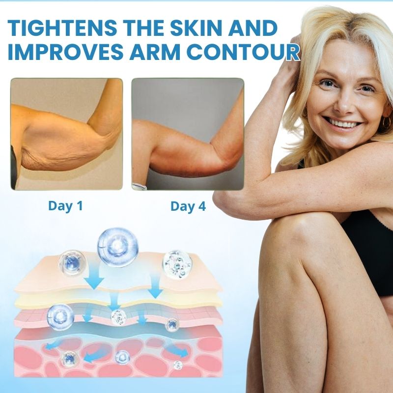 NoSaggy™ | Professional Skin Firming Cream