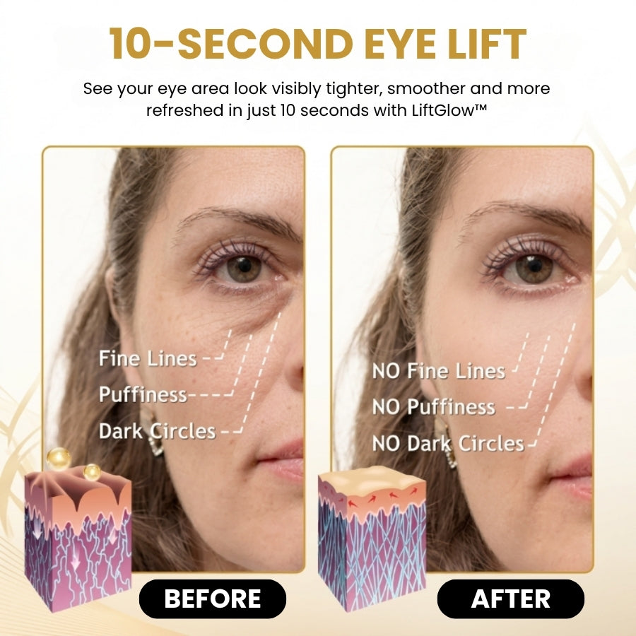LiftGlow™ | Eye Anti-Wrinkle Roll-On