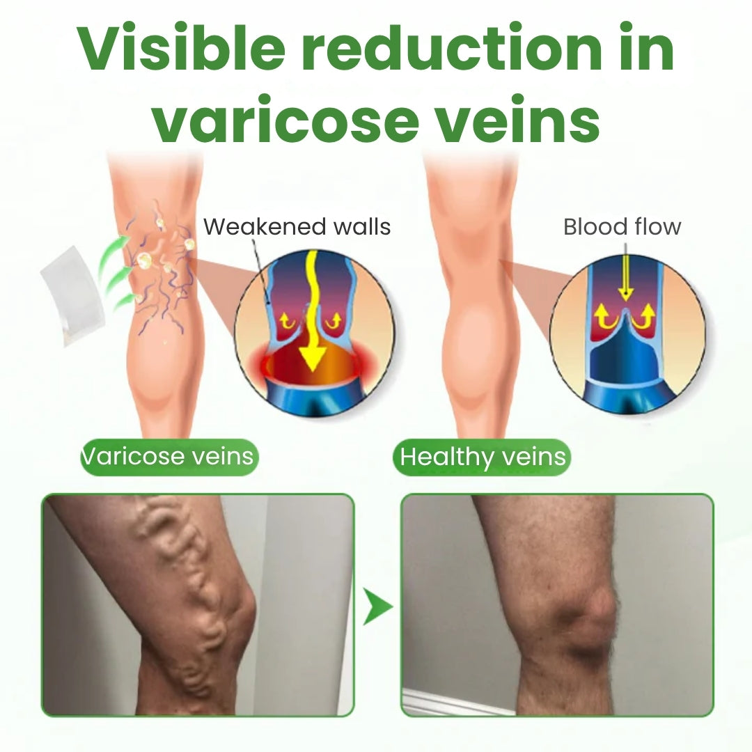 VeinHeal™ | Microneedle Patch