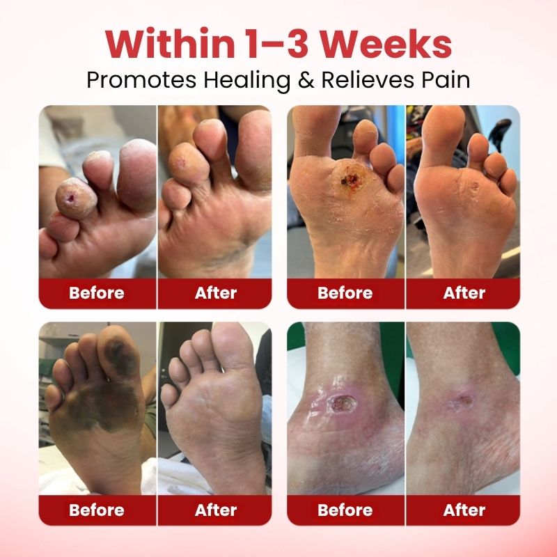 VitaGluco™ | Diabetic Skin Repair Cream