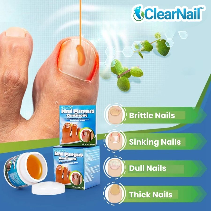 ClearNail™ | Fast Antifungal Ointment