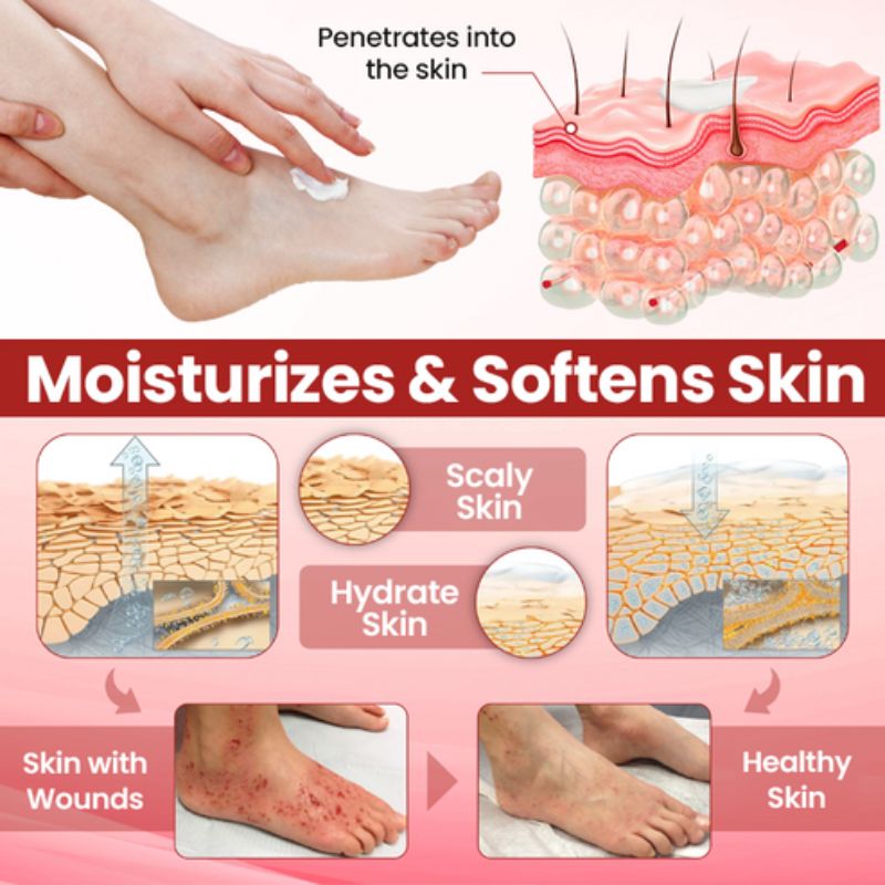 VitaGluco™ | Diabetic Skin Repair Cream