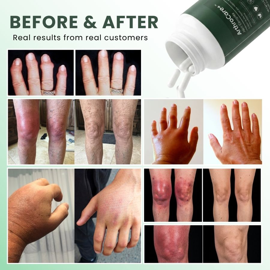 ArthroCare+™ |  Daily Joint Support Capsules