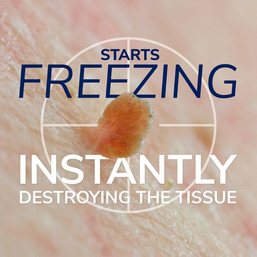 DermFrost™ |  Skin Tag Cryo Recovery Spray