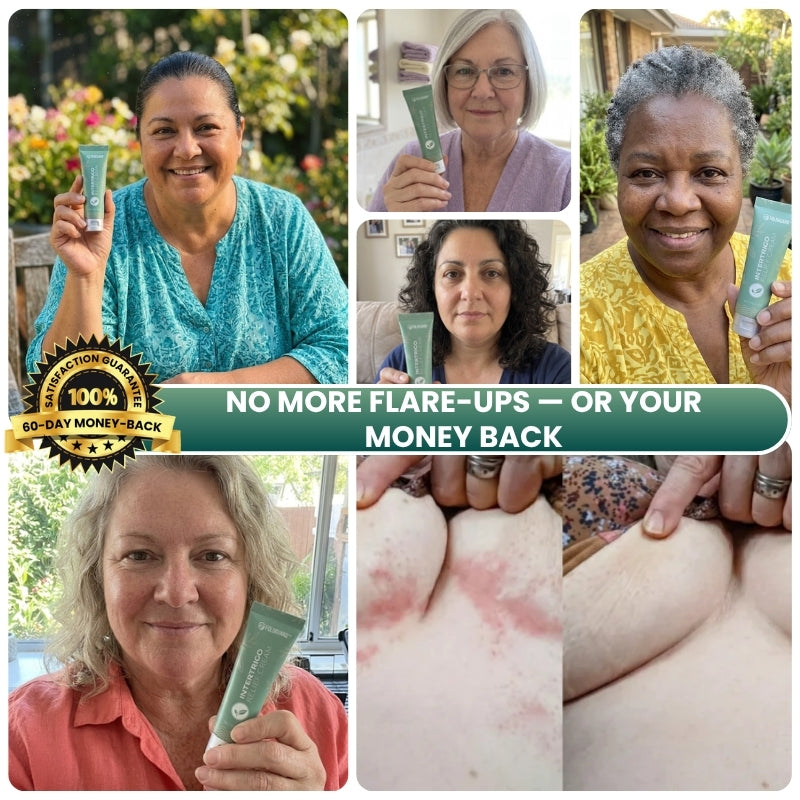 FoldGuard™ | Plant-Based Intertrigo Cream