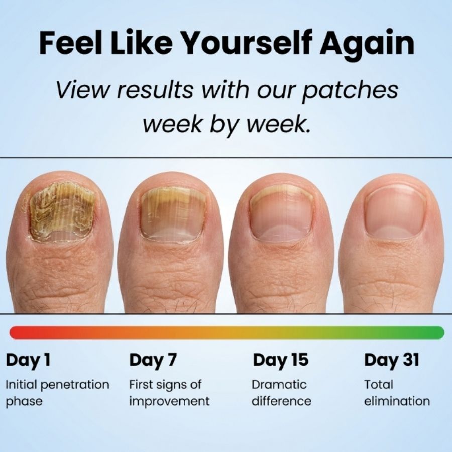 NailRestore™ | Night Nail Fungus Patches