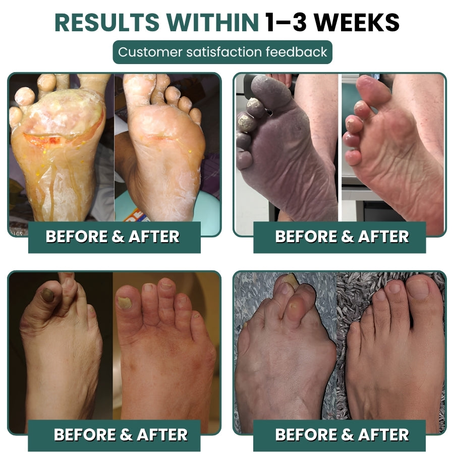 NeuroPulse™ | Neuropathy Support Capsules