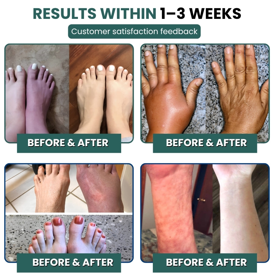 NeuroPulse™ | Neuropathy Support Capsules