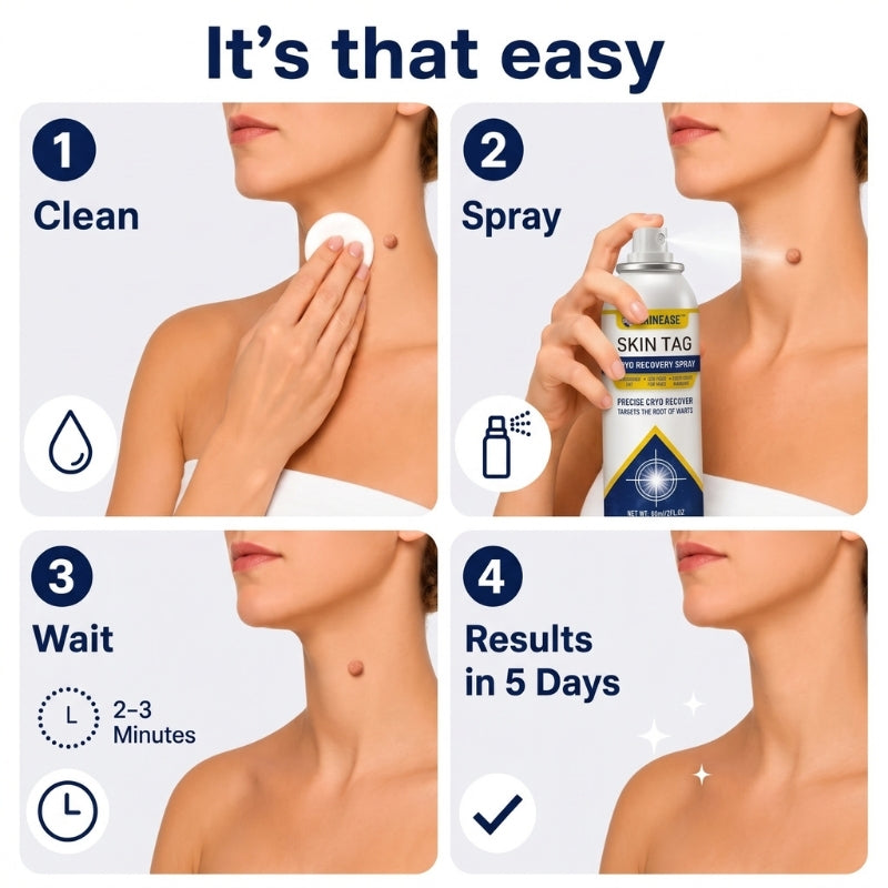 SkinEase™ | Cryotherapy Spray
