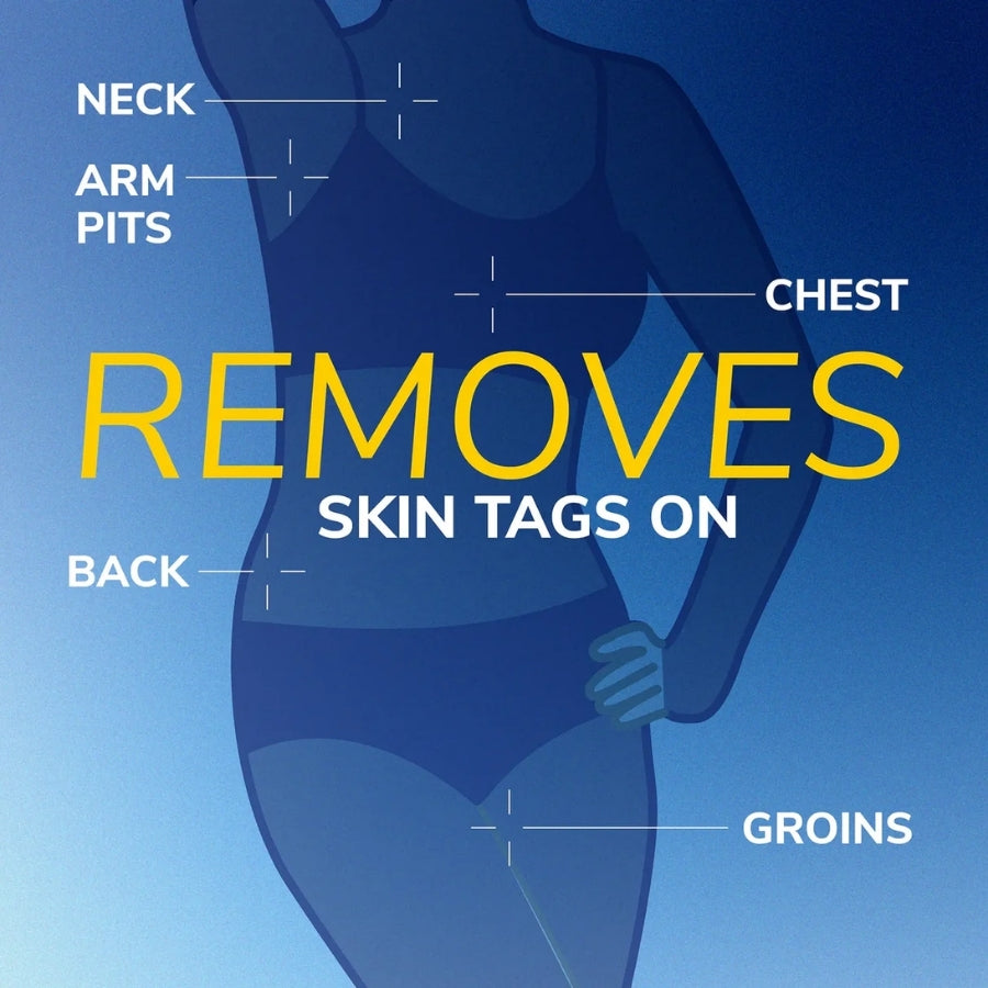 DermFrost™ |  Skin Tag Cryo Recovery Spray