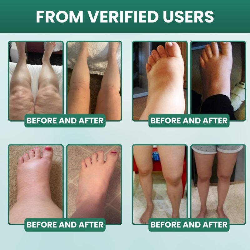 Lymphoria™ | Lymphatic Drainage Wellness Drops