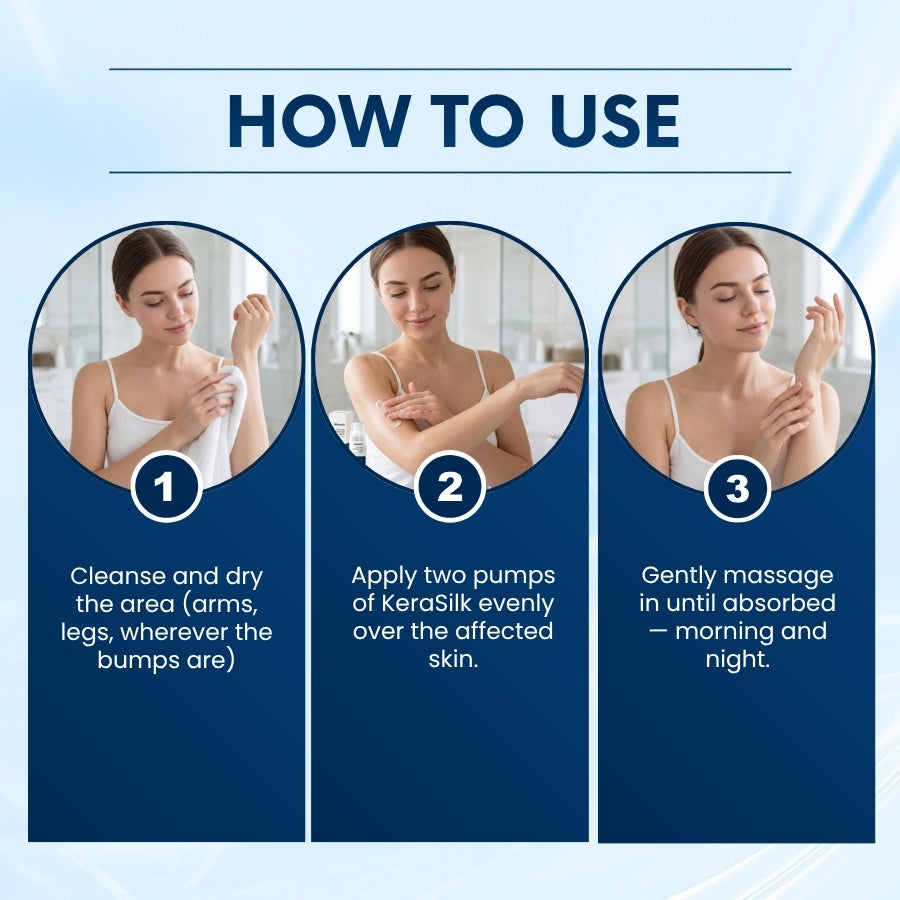 KeraSilk™ | Clear Out Skin Clarifying Cream