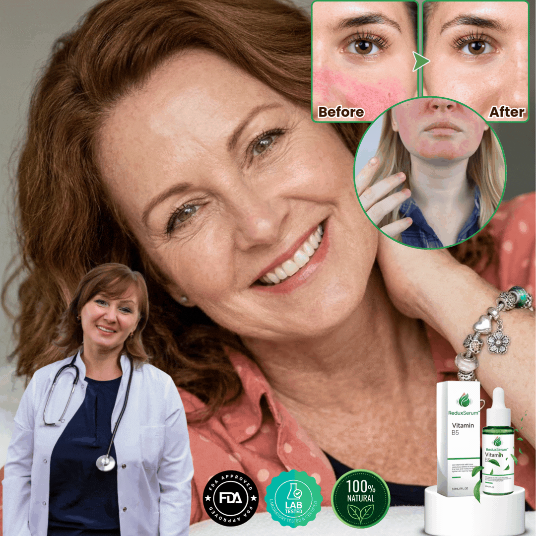 ReduxSerum™ | Anti-Redness-Serum