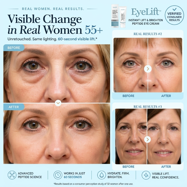 EyeLift™ | Instant Lift & Brighten Eye Cream