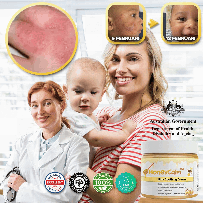 HoneyCalm™ | Soothing Cream for Baby
